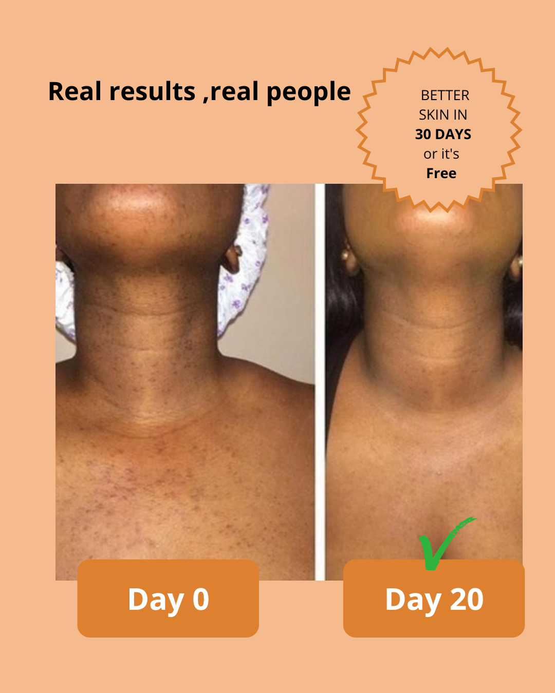 Kojic Acid & Turmeric Soap