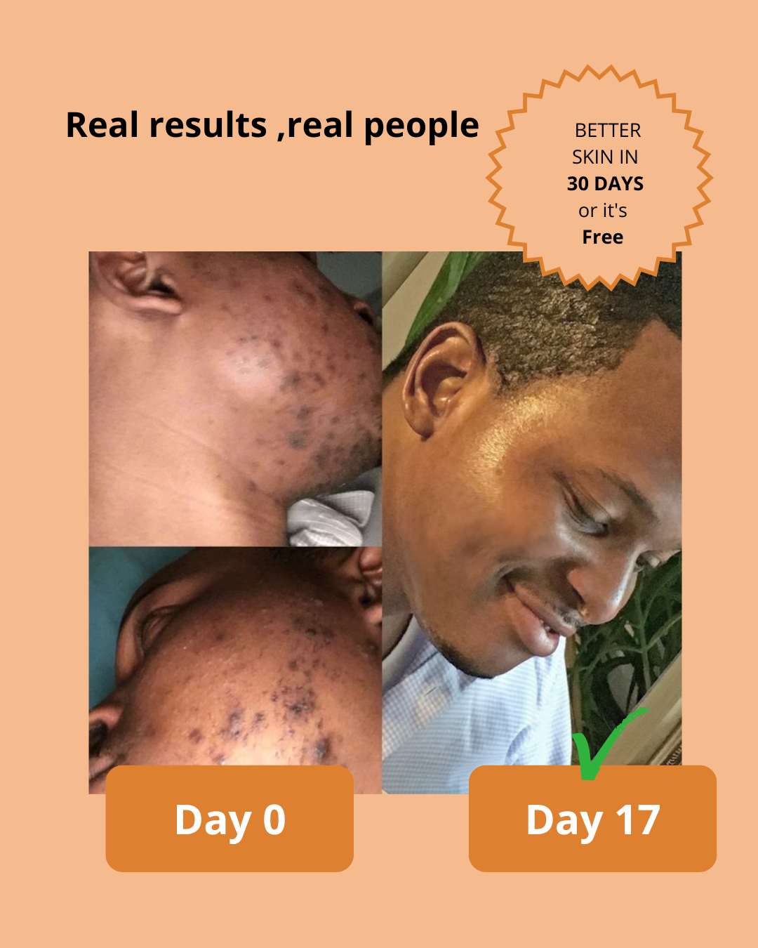 Dark Spot Serum for Sensitive Skin