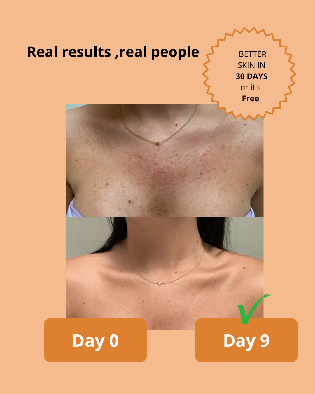 Kojic Acid & Turmeric Soap