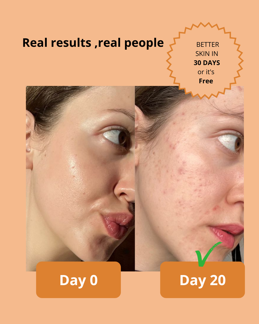 Dark Spot Serum for Sensitive Skin