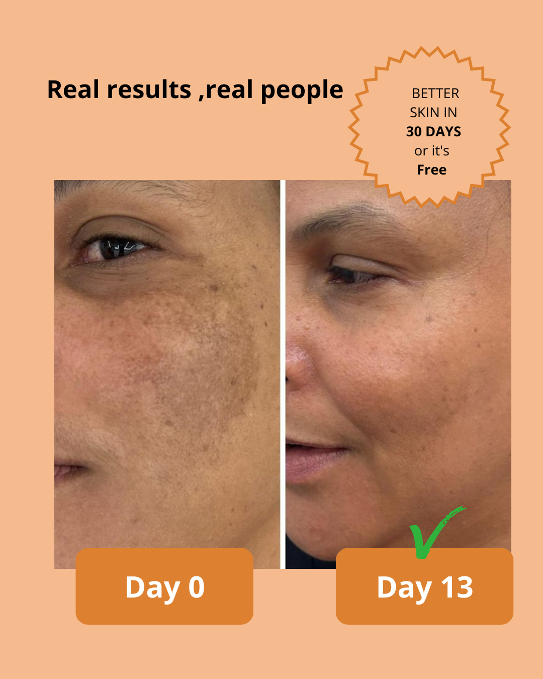 Kojic Acid & Turmeric Soap