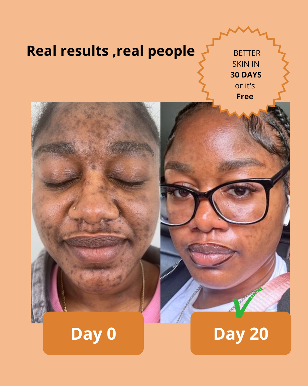 Dark Spot Serum for Sensitive Skin