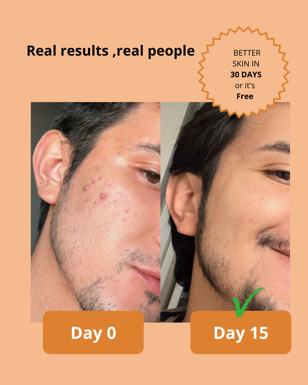 Dark Spot Serum for Sensitive Skin