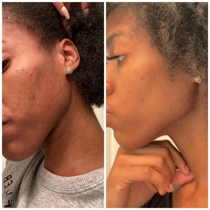 Kojic Acid & Turmeric Soap